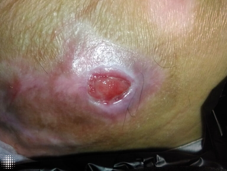 Week 4