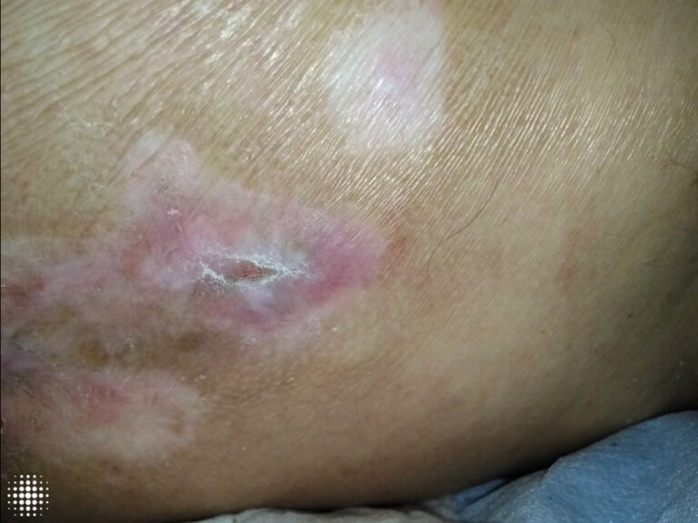 Week 7